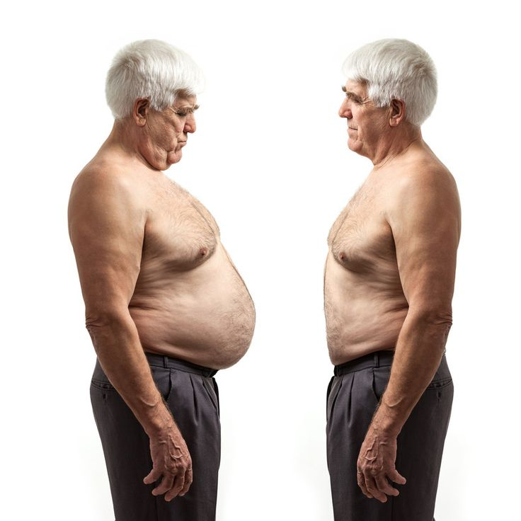 Why try our medical weight loss program